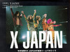 有人知道X JAPAN吗?